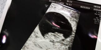 First baby ultrasound