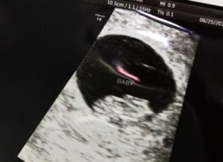 First baby ultrasound